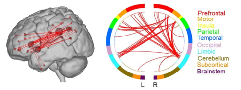 connections des lobes du cerveau et créativité